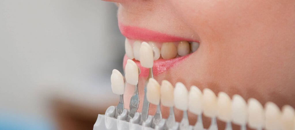 fatete dentare